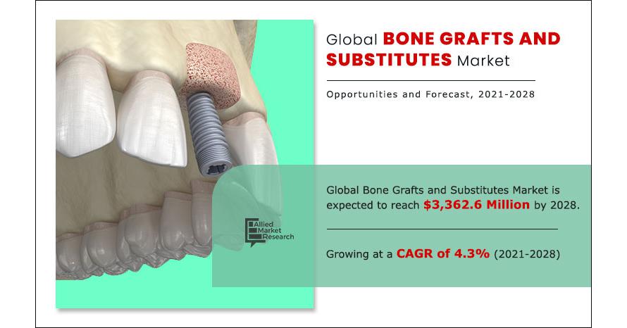 Bone Grafts And Substitutes Market To Hit Million By With