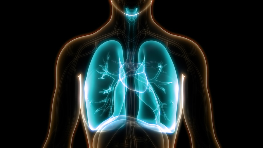 Just three months after the initial treatments, Personalized Stem Cells, Inc (PSC), a human adipose-derived stem cell company, announces enrollment is complete for COVID-19 FDA approved stem cell clinical trial licensed to Sorrento Therapeutics (Nasdaq: SRNE, "Sorrento")