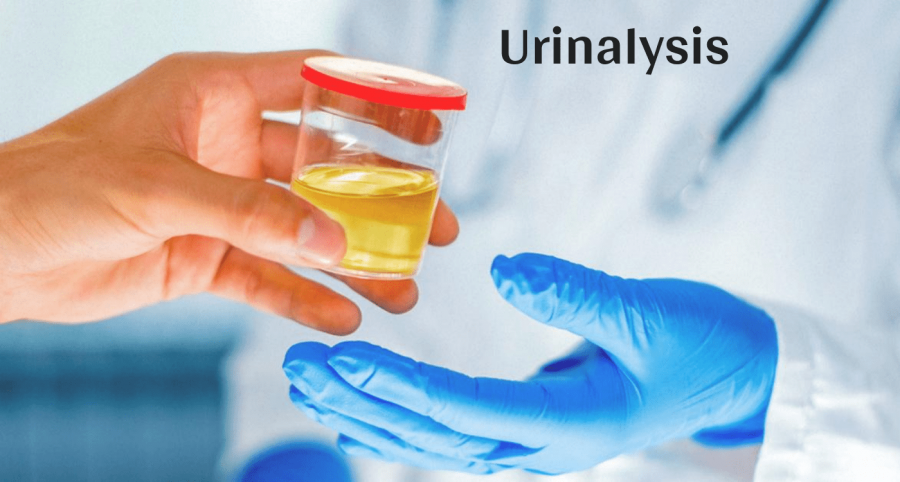 Urinalysis Market| AMR