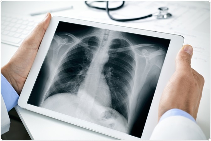 Digital Radiography Market Overview: Digital Radiography Market