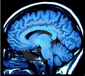 Christopher Martin, a stroke survivor, has made a remarkable recovery following his participation in the Neurologic Stem Cell Treatment Study