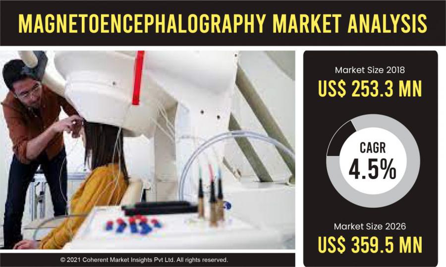 Magnetoencephalography Market: An Investor’s Guide to Understand Market Variation Globally | Electrical