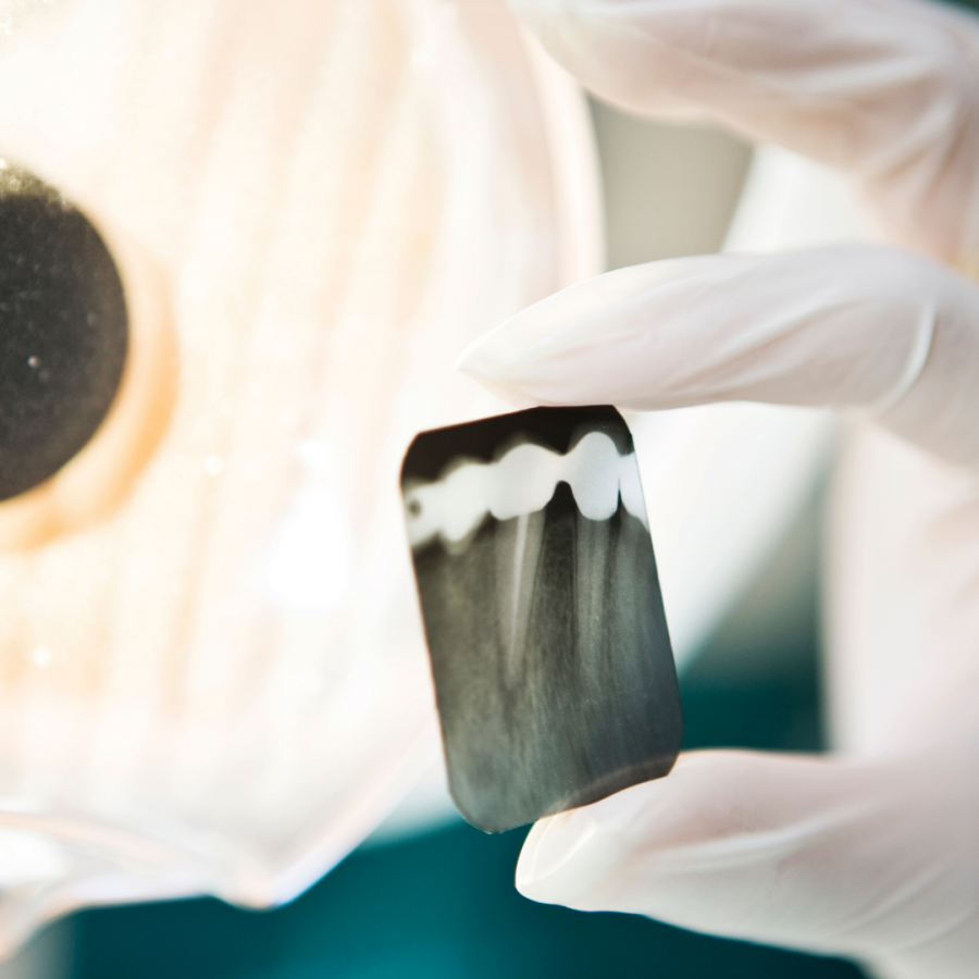 Global dental imaging market