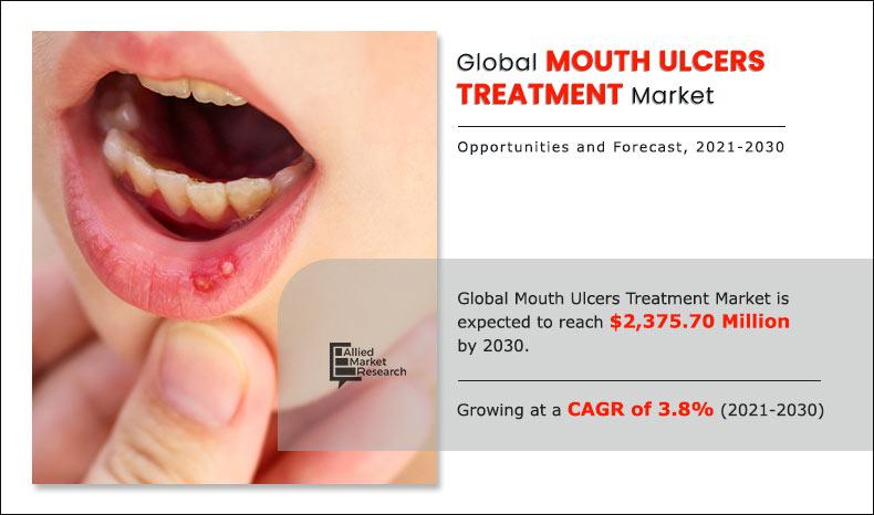 Mouth Ulcers Treatment Market
