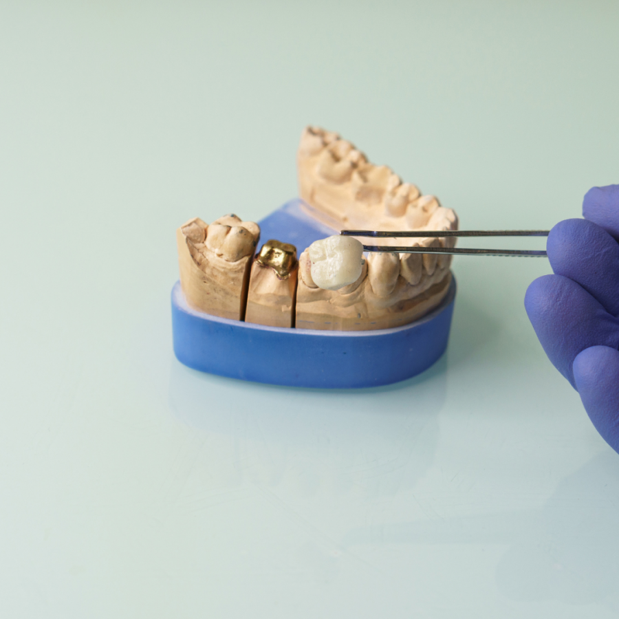 Glidewell Dental Leads Global Dental Prosthetics Market, Followed by Dental Services Group and Modern Dental