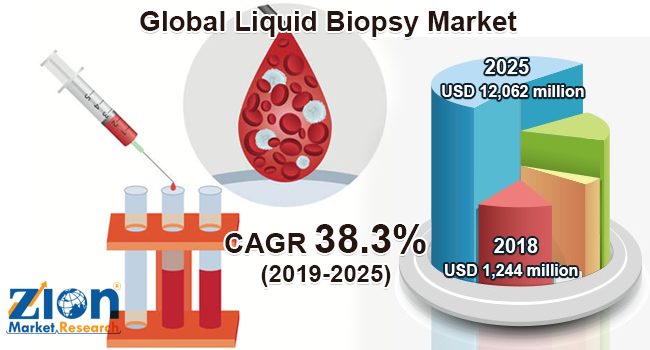 Global Liquid Biopsy Market