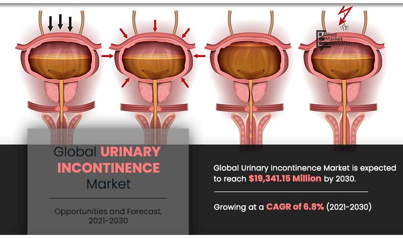 urinary-incontinence-market-A