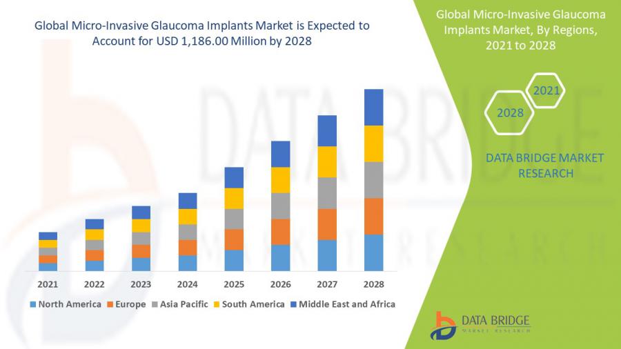 Micro-Invasive Glaucoma Implants Market to Register Highest CAGR Growth of 30.1% by 2028