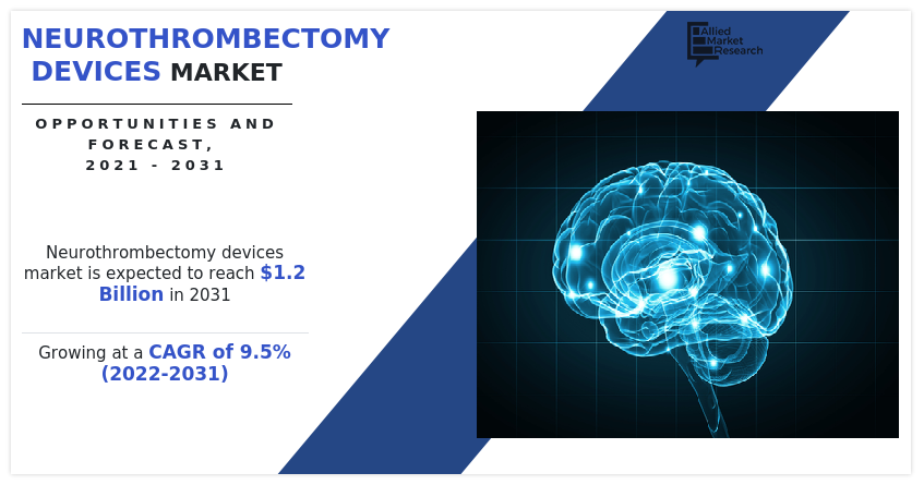 Neurothrombectomy Devices market Size, Share, SWOT Analysis, Business pportunities, Trend Analysis 2021-2030
