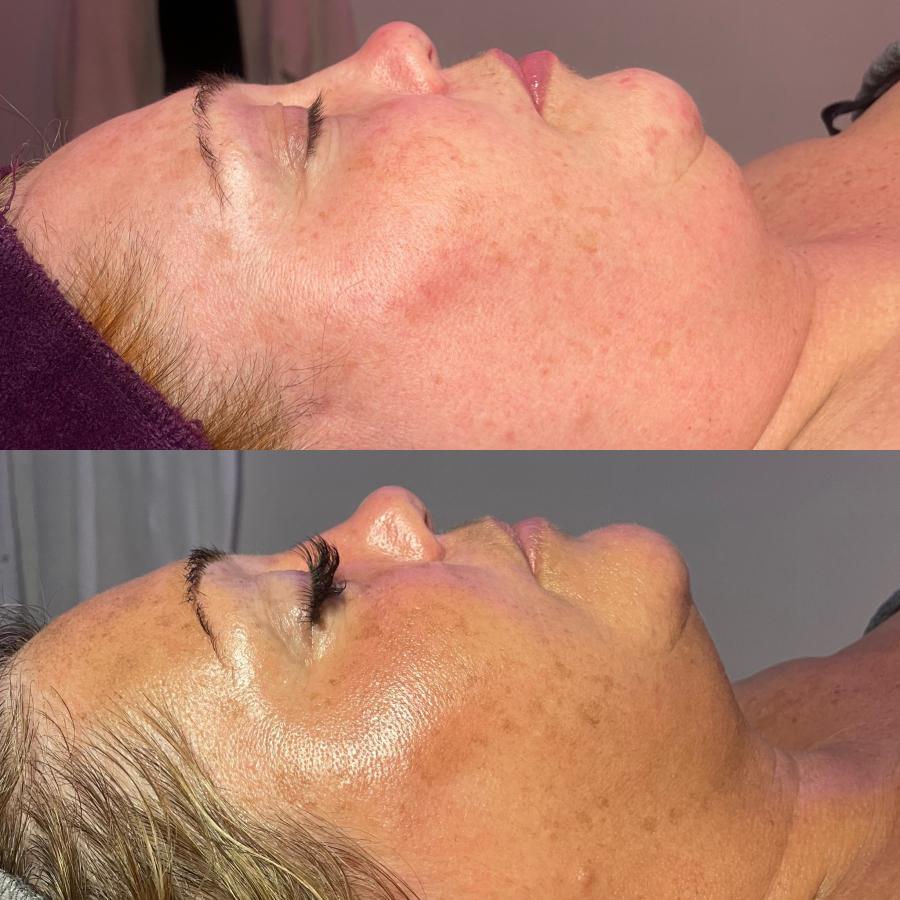 Skin hydration levels double and skin elasticity increased by 89%