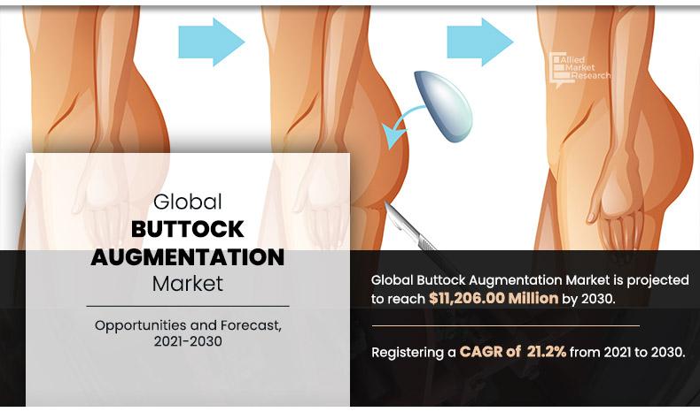 Buttock Augmentation Market - Infographics- AMR