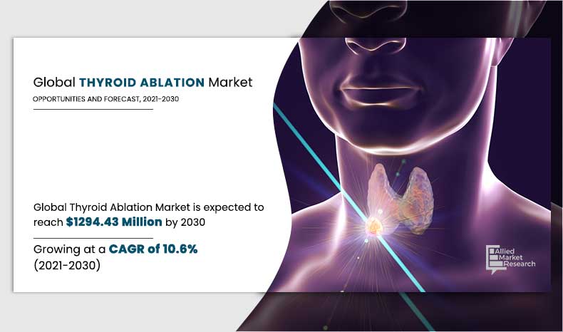 According to the report, the global thyroid ablation devices industry generated $472 global thyroid ablation devices industry