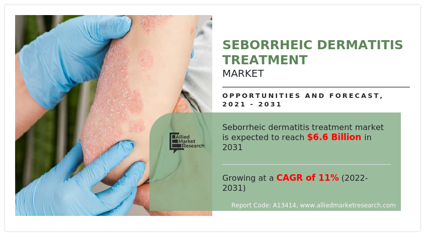 seborrheic dermatitis treatment industry 2030