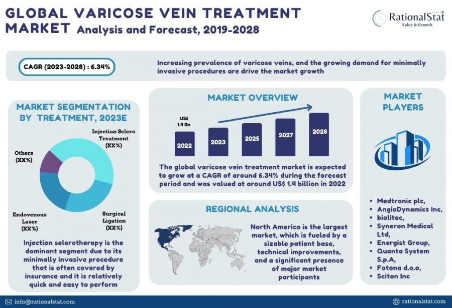 Varicose vein Treatment | RationalStat