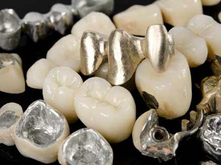 The dental alloys industry plays a crucial role in the field of dentistry by providing materials that are used in various dental procedures and restorations Dental Alloys Market Report
