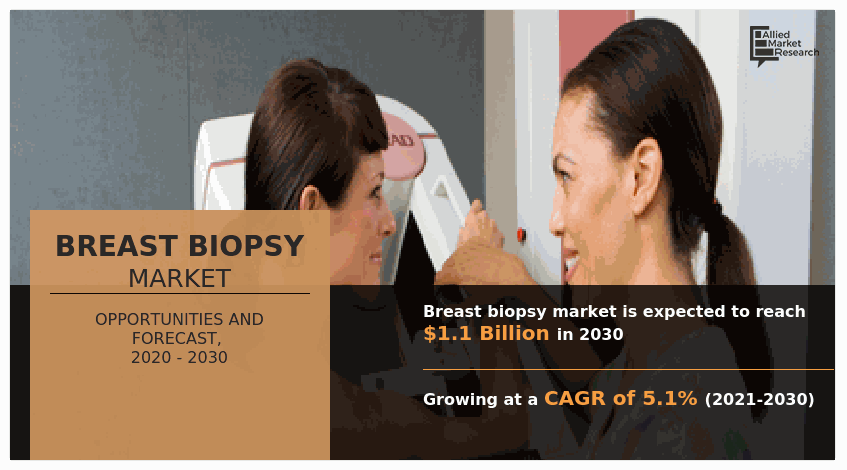 Breast Biopsy Market Research, 2030