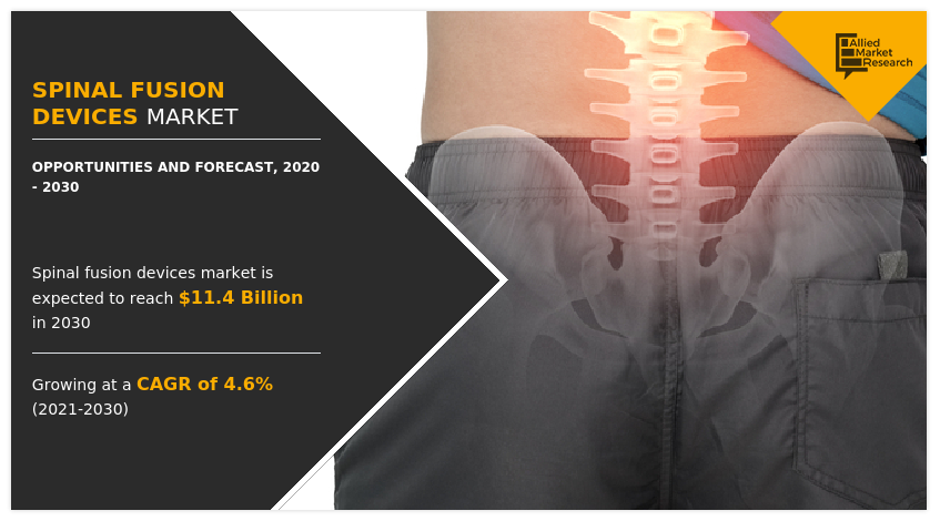 Spinal Fusion Devices Market: Understanding Key Drivers and ...