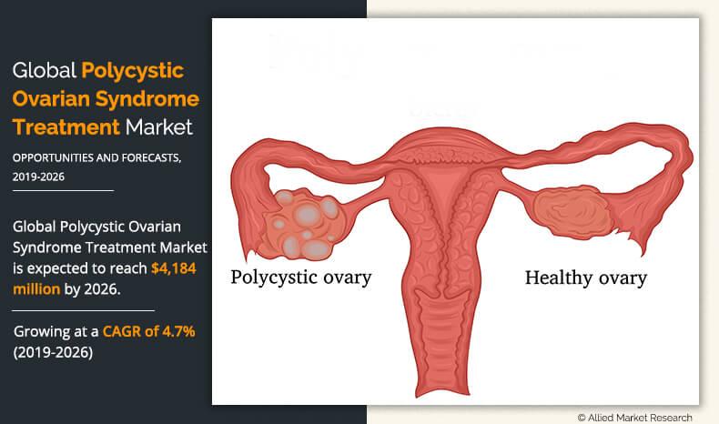 Polycystic Ovarian Syndrome (PCOS) Treatment Market Study