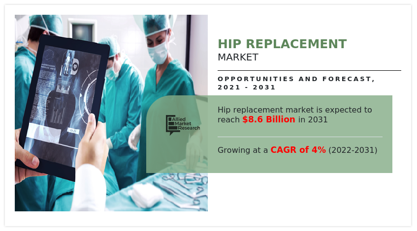 Hip Replacement Market Guide