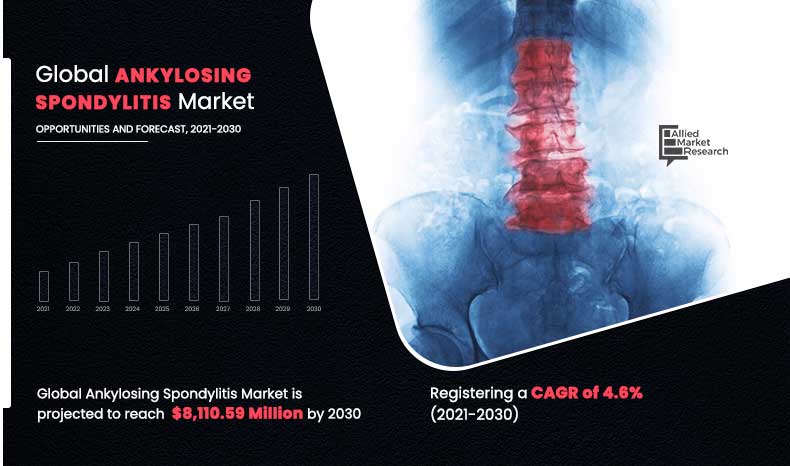  Ankylosing Spondylitis Market: Trends, Treatment, and Projections