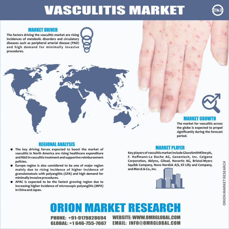 Vasculitis Market Research By OMR