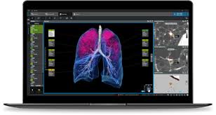 Lung Cancer Screening Software Market 2024-2032