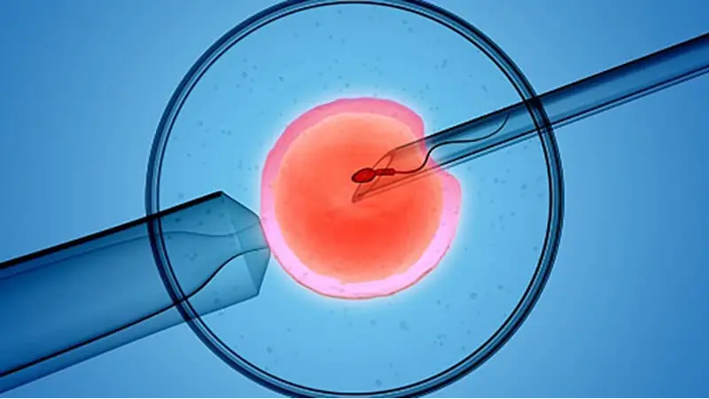 U.S. In Vitro Fertilization Market 2024-2032