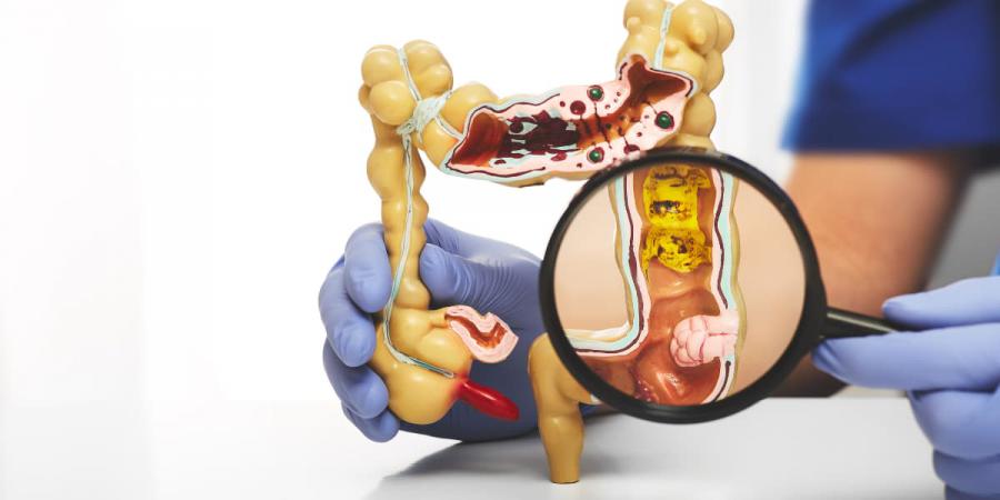 Colon Hydrotherapy Market 2024-2032