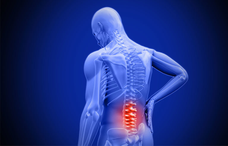 Global Chronic Lower Back Pain (CLBP) Market