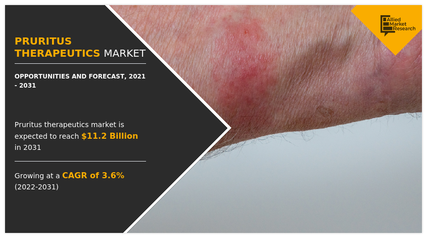 Pruritus Therapeutics Market growth and demand