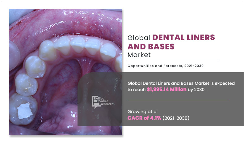 Dental Liners and Bases Market to Reach $1.99 Billion, Globally, by 2030 at 4.1% CAGR: Allied