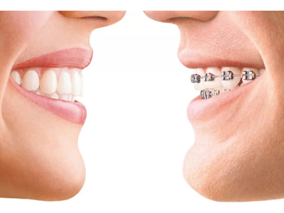 Orthodontics Market Size