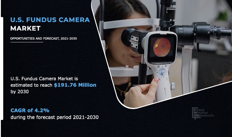 us-fundus-camera-market-A160662