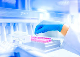 Sample Preparation Market