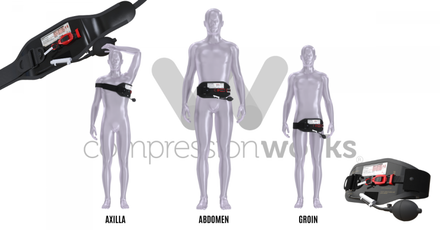 Illustration of the AAJT-S device applied at the axilla, abdomen, and groin for hemorrhage control and trauma care."