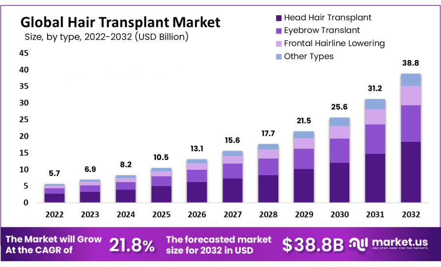 Hair Transplant Market Size