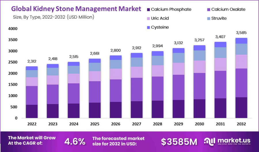 Kidney Stone Management Market Size Analysis