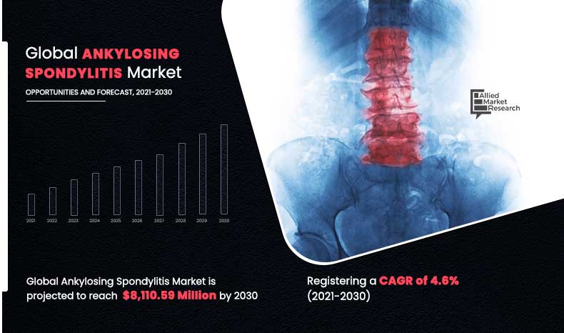 Ankylosing Spondylitis Market--