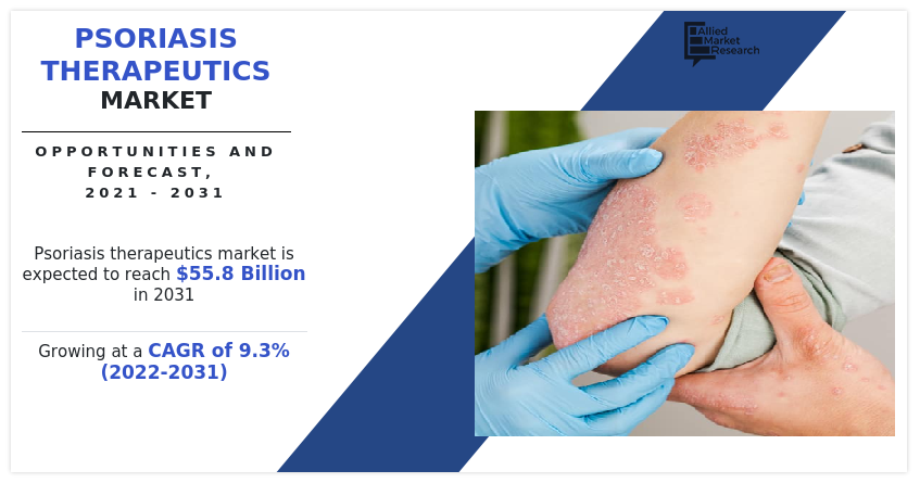 Psoriasis Therapeutics Market Research Report