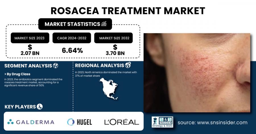 Rosacea Treatment Market