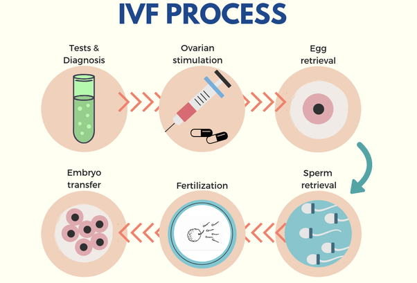 Europe In Vitro Fertilization (IVF) Market 2025