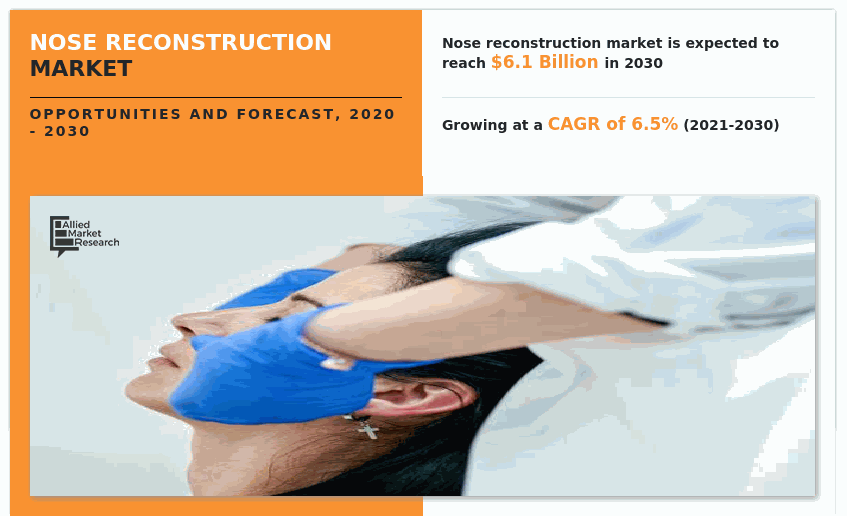 Nose Reconstruction Market--