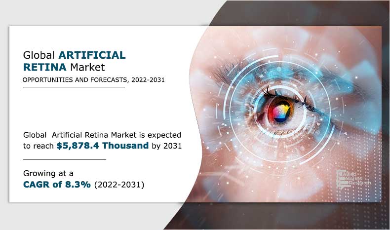 Artificial Retina Market---