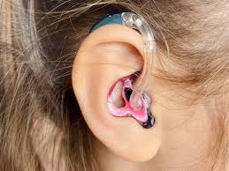 Hearing Aids Market 2025