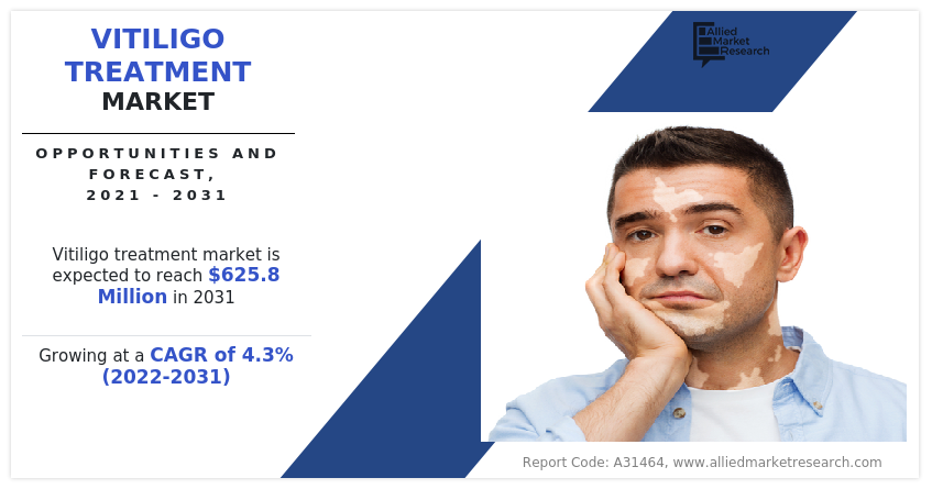 Vitiligo Treatment Market---