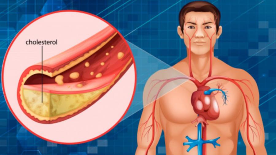 Cholesterol API Market