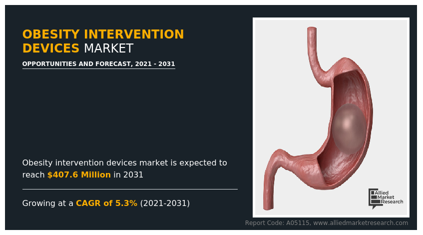 The global obesity intervention devices market is experiencing a significant upswing, driven by the surging global prevalence of obesity, increased public health awareness, and the emergence of advanced weight-loss technologies Obesity Intervention Devices Market growth