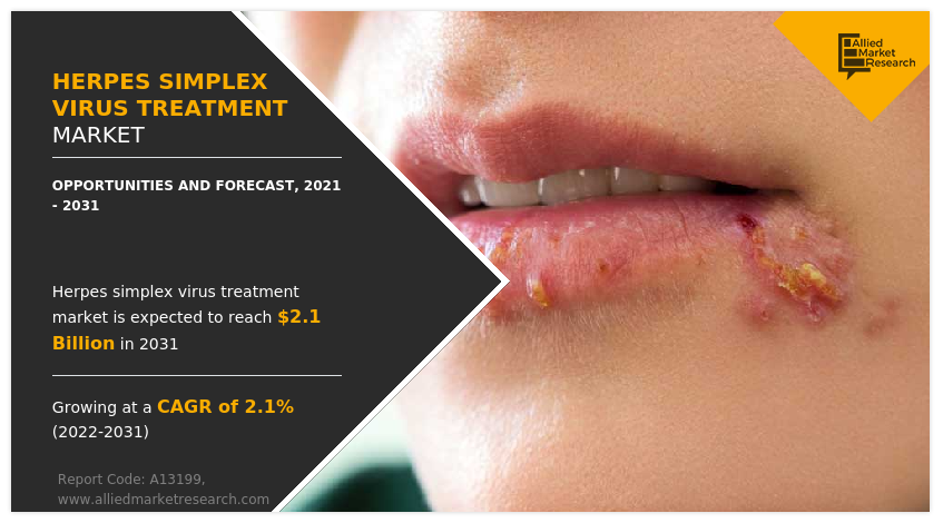 Herpes Simplex Virus Treatment Market Growth