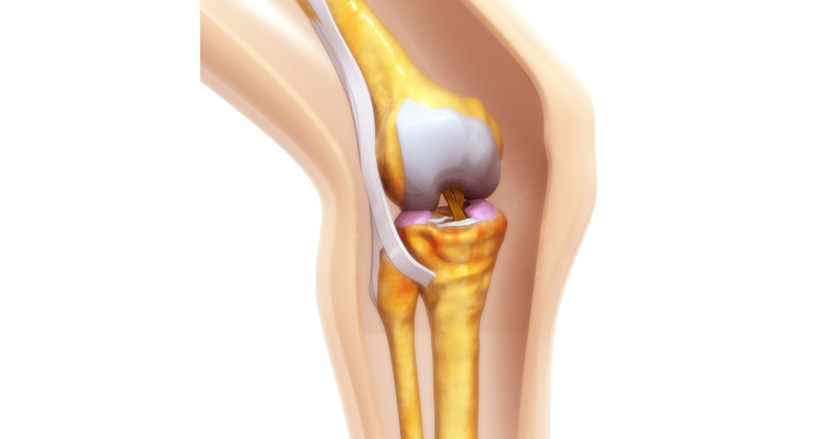 Robotic Knee Replacement Technology to Bolster US Large Joint Devices Market