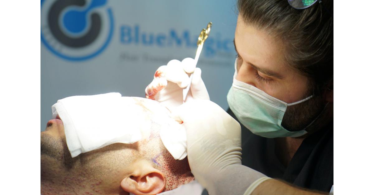 BlueMagic Group Celebrates the Completion of 21,000 Successful Hair Transplant Surgeries